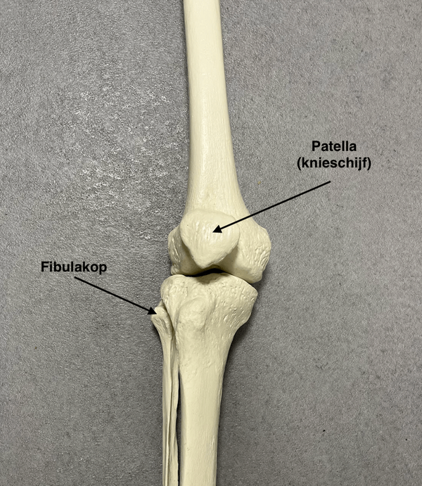 Patella (knieschijf) en fibulakop